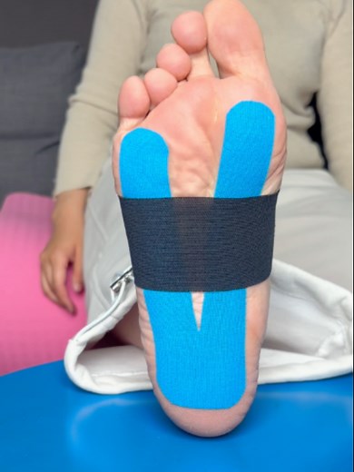 How to tape a foot for arch pain? Kinesiology tape provides short-term relief for foot arch pain (plantar fasciitis) by supporting the arch, reducing tension on the plantar fascia, and alleviating strain.#fyp #MuscleSoreness #kinesiotape #recovery #foot
