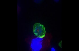 Watch a killer T cell in action as it attacks a cancerous cell.