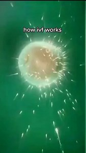 how ivf works #infertility #IVF #ttc #infertilitywarrior #ivfwarrior #infertilityjourney #Reels #reelsvideo #reelsviral #reelsfb #reelinstagram #reelsinstagram | Steven Palter