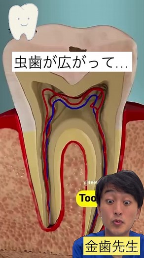 歯科医師も驚く巨大なドリル😆#歯医者 #dentist
