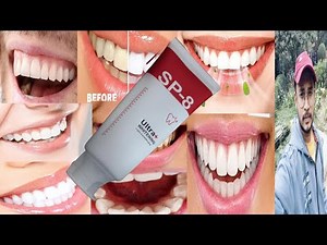 Sp-8 Toothpaste | Honest Review