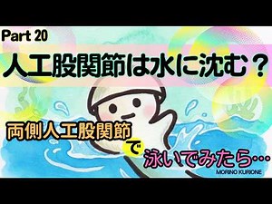 Part20 人工股関節でプールで泳ぐと手術前より水に沈んでしまうのか【両足人工股関節置換術】