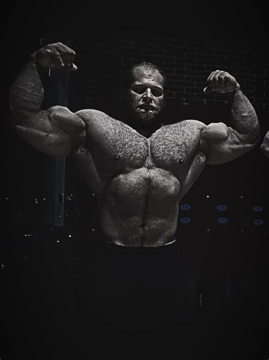 Understanding Testosterone Levels in Men