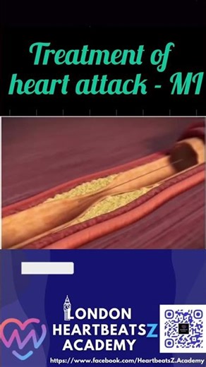 Life-Saving Heart Attack Treatments, Discover essential MI procedure #HeartAttack #LifeSaving