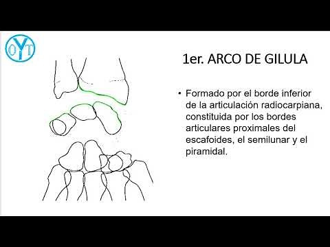 Arcos de Gilula, de los huesos del carpo