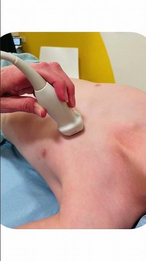 Positioning for Optimal Parasternal Views #Shorts #echocardiography #pediatrics