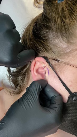 rate daith pain level from 1-10 in the comments😭💉 #piercing #daithpiercing #goldjewelry #cartilagepiercings #vancouverbc