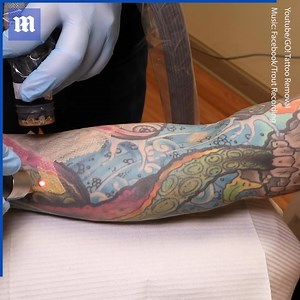 54K views · 156 reactions | This full sleeve tattoo removal is incredible!  | Daily Mail Video | Facebook