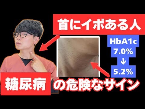 [HbA1c 7.0% → 5.2% without medication] Pancreatic care eliminates neck warts!! Exercises that reg...