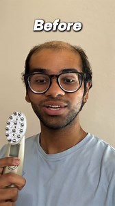 Hair loss ends here. Introducing Ruby — the next generation of hair restoration. Harnessing the power of clinical red light laser therapy and microcurrent technology, Ruby is engineered to target thinning at the root. In just 8 minutes a day, it nourishes dormant follicles, reactivates growth, and supports visibly thicker, stronger hair — all from the comfort of home. ✓ 100% drug-free and non-invasive ✓ No medications. No side effects. ✓ Clinically backed. Customer proven. Our Sale Includes: ✨ P