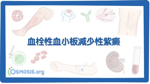 【Osmosis】血栓性血小板减少性紫癜（中英字幕）