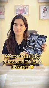 2.5 month ka baby ultrasound me kaisa dikhta h🥰
