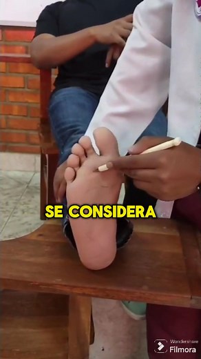 Qué es el reflejo de babinski? | Aaron Picq