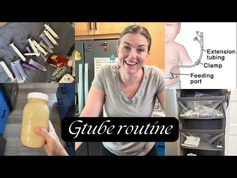 Our new routine with a feeding tube