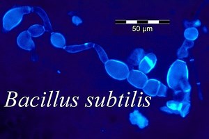 Bacillus subtilis - Alchetron, The Free Social Encyclopedia