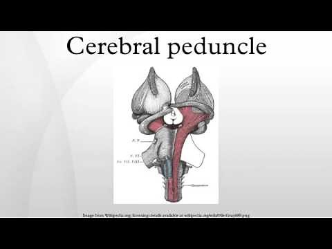 Cerebral peduncle