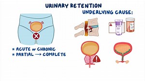 Video: Urinary retention: Clinical sciences - Video Explanation! | Osmosis | Osmosis