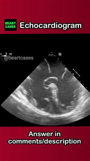 Echo Clip 47 complete AVCD