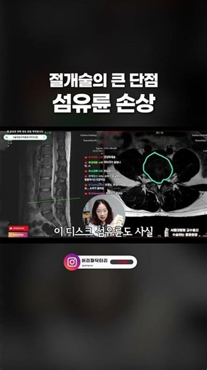 허리 절개술 vs 최신 수술법 비교
