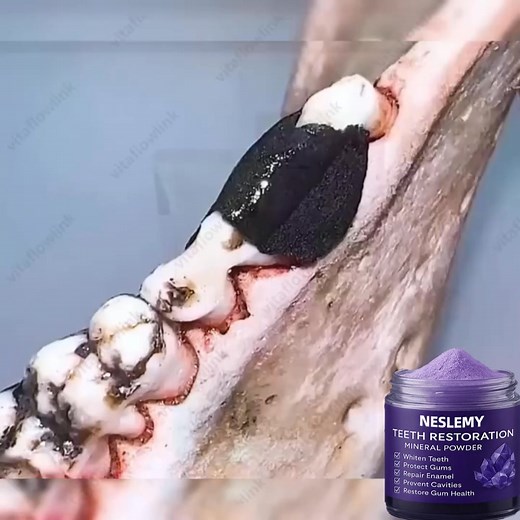 🦷 “I used to wake up with sore, bleeding gums and couldn’t drink anything cold without pain.” I tried everything — sensitive toothpaste, mouthwash, even supplements — nothing worked long-term. Then I found this natural mineral powder. 💥 My sensitivity is gone. 🦷 No more bleeding gums. 😁 My teeth feel stronger and look whiter. It’s easy to use, tastes clean, and actually works. I finally enjoy eating and smiling again — pain-free. https://www.newmeander.com/products/teeth | Matching Mystery S