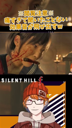 [※Viewer discretion advised※ Sound effects so painful you've never heard them before lol] Minato'...