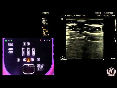 How to use Any Ultrasound Machine - Knobology and Physics - Made Super Simple