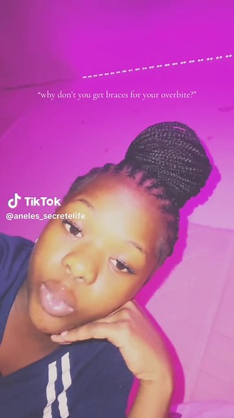 aneles_secretelife (@aneles_secretelife)’s video of overbite teeth