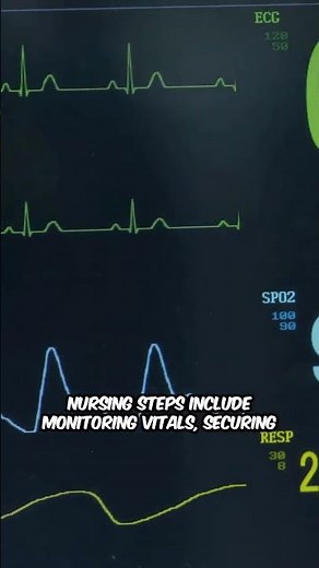 Understanding Junctional Rhythms #JunctionalRhythm #ECG #RhythmStrips #CardiacNursing #NCLEX #Shorts