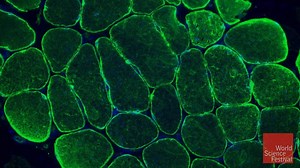 From lab-grown organs to tissue engineering, regenerative medicine holds the potential to deliver eternal life. How close are we to this new future of human health? Check out our newest video, Forever Young: The Promise of Human Regeneration to find out: https://bit.ly/2FWRxeX | World Science Festival