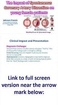 The impact of Spontaneous Coronary Artery Dissection on young female patients