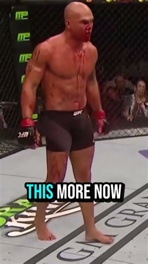 Matt Brown Explains Why Robbie Lawler Is Different…