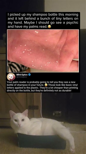 I Wasn't Expecting Tiny Letters On My Hand