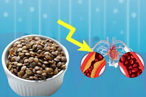 10 Benefits Of Eating Lentils: Why They Are Good