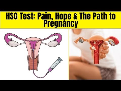 HSG Test Explained: The Hidden Fertility Scan That Changes Everything