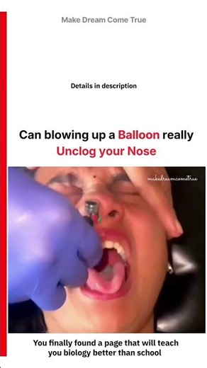 🎈 Can Blowing Up a Balloon Really Unclog Your Nose👃| MDCT