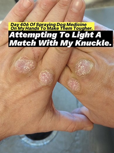 Making Hands Tougher with Dog Medicine Experiment