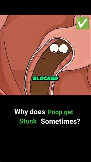 why DOES POOP get STUCK SOMETIMES? #3danimation #animation #animationvideo #anime #sus #shorts