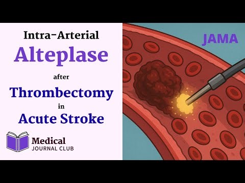 Intra-Arterial Alteplase after Thrombectomy in Acute Stroke (PEARL) | JAMA | Med Journal Club