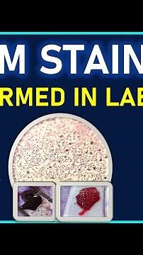 Procedure of GRAM STAINING Performed In Lab | Bacterial Staining Technique | Microbiology