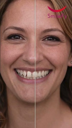 AI-Powered Smile Design Instantly