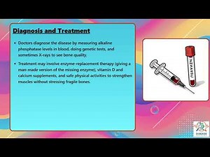 Hypophosphatasia Explained Causes, Symptoms and Treatment, All Insights