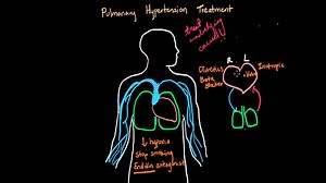 Pulmonary hypertension treatment