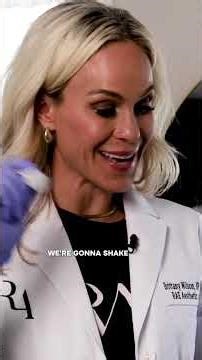 How to prep Sculptra