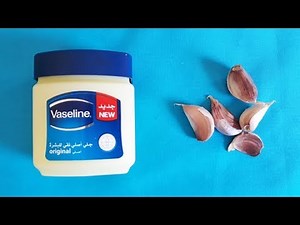 الفازلين و الثوم لانبات فراغات الشعر و الصلع من أول استعمال | سريع ومذهل للغاية