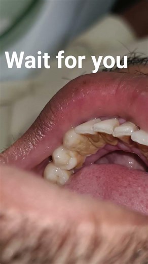 pyra की सफाई