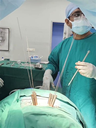 Minimally Invasive Spine Fixation (MIS)