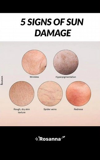 5 Signs of Sun Damage ☀️ | Skin Awareness#SunDamage #SkincareTips #SkinAwareness