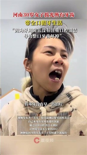 30岁女子拔光所有牙齿，带全口假牙生活：因有牙周炎且未注重口腔清洁，导致牙齿坏掉