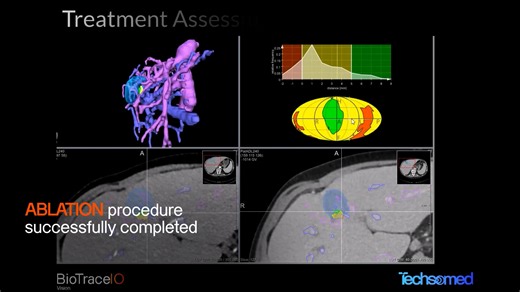 Treatment Assessment