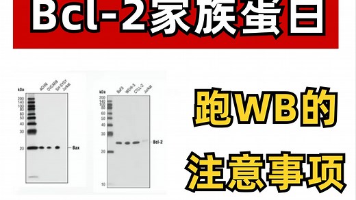 Bcl-2家族蛋白跑WB，这几点要注意！